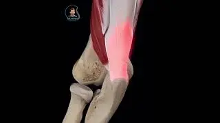 Triceps Tendinopathy