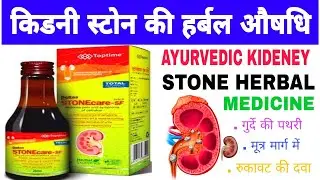 Toptime Stone care sf syrup for kidney stone Ayurvedic medicine benefits