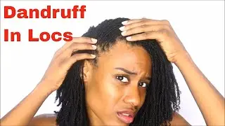 Dandruff Stuck In My Locs..?