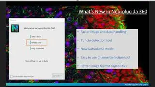 Webinar: See the New Features of Neurolucida 360 2020.3.1