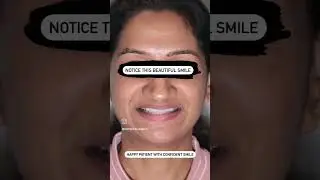 Swift smile makeover at navi mumbai