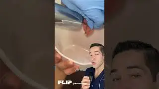 ⛔️WARNING: Stop Using Q-Tips Before It&rsquo;s Too Late! Real Ear Cleaning by a Pro