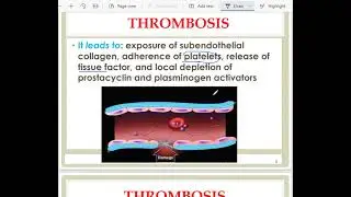 Circulatory Disturbances