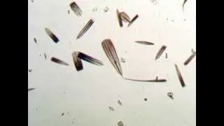 Moth Scale Magnification