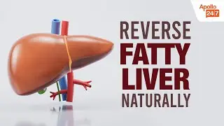Reverse Fatty Liver Naturally: What Really Works