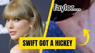 There's a red mark on Taylor Swift's neck, a hickey from Travis Kelce?