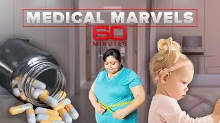 Medical marvels: Remarkable breakthroughs, discoveries and stories | 60 Minutes Anthology