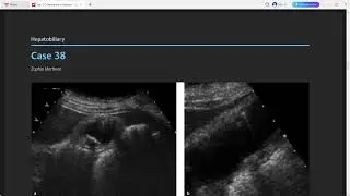 TOP 3 DIFFERENTIALS RADIOLOGY