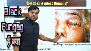 Black Fungag हैं क्या A2 Sir ने कहा #a2sir #a2motivation #arvind arora
