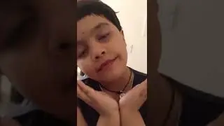 funny video with broken teeth🦷