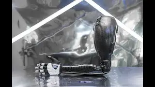 Trans-Humeral Myo-Electric Prosthesis | Prosthetic Innovations