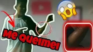 ME Queimei! Ft.Desafio Do Canal.