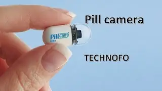 pill camera treatment | simply jpr
