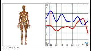 CheckUp 100+ Parameters Body Health at-Home - Metatron Hospital Upgraded Remote Online Report Within