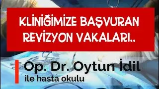 Bize başvuran (penis büyütme) revizyon vakaları..