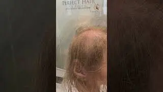 TOPPER - Naturalna fryzura od razu! Perfect Hair Clinic Klinika Włos&oacute;w  Warszawa Zadzwoń 607 622 229