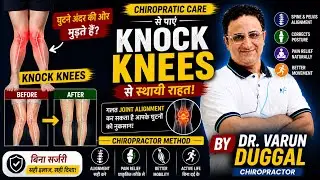Chiropractor Treatment For Patient With Knock Knees