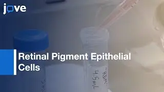 Retinal Pigment Epithelial Cells Differentiation from iPSCs | Protocol Preview