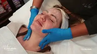 Pregnancy-Safe Chemical Peel | Katinka&rsquo;s Treatment with Vashnee at Dr Alek Nikolic&rsquo;s Practice