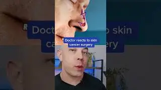 Surgery for Skin Cancer! | 208SkinDoc