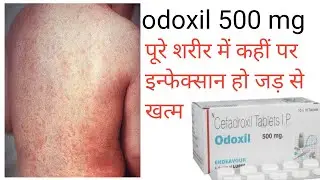 odoxil 500 mg uses in hindi odoxil 250 mg benefit said Effect