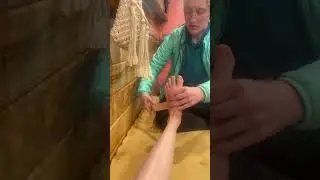 Кольцевая повязка на кубовидную кость для облегчения боли в боковой части стопы при ходьбе.