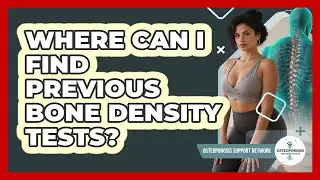 Where Can I Find Previous Bone Density Tests?