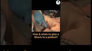 Defibrillator shock (How & When to give) #icu #emergency #cardiology
