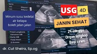 HASIL USG 24 MINGGU | Janin PEREMPUAN organ lengkap