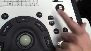 Zoom Feature on Whale Ultrasound System