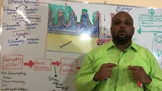 Autoimmune Chronic Gastritis التهاب المَعِدة المُزمِن ذاتي المناعة