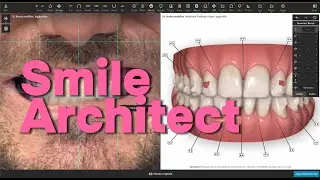 Smile Architect Invisalign