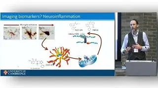 Microglia and Neuroinflammation | Talk from James Rowe