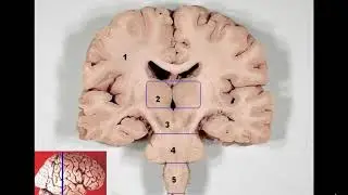 Disorders of Motor Function part 1