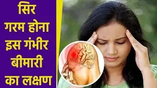 सिर गरम होना Heat Stroke Symptoms, क्या है सिर गरम होने का कारण | Boldsky