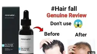 Minimalist hair growth activities 18% genuine review  #minimalist @studymotivationiq