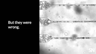 How tumor cell clusters spread | Science News