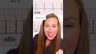 What Afib with RVR looks like on a rhythm strip