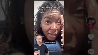 Breakouts after Microneedling