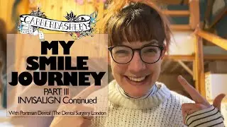 My Smile Journey | PART III - Invisalign with Portman Dental Care