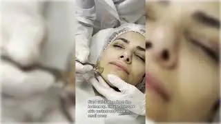 Pluryal Mesoline System : A 3-Step Mesoporation Solution