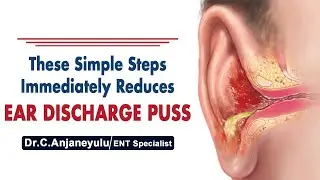 Puss in the Ear | Ear Infection | Ear Discharge | ENT Expert Dr C Anjaneyulu | Socialpost Healthcare