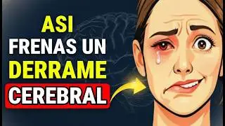 DERRAME CEREBRAL: Tienes 3 HORAS Para Salvar Tu Cerebro (Protocolo FAST)