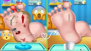 ASMR | Surgery to Remove Large Plantar Warts Animation | Corn Foot Calluse HPV Treatment 사마귀 足底疣贅