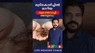 മുടികൊഴിച്ചിൽ മാറിയ മുദ്ര തെറാപ്പി അനുഭവം #lifehealingcoach #anooppatter #mudratherapy