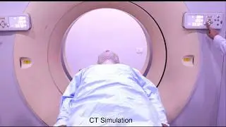 Radiotherapy Treatment