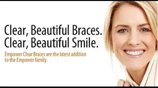 Empower Braces System - Windermere Orthodontics