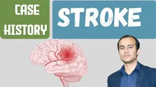 History Taking in Stroke (CVA) | Complete Clinical Guide