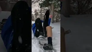 ATTACKED!!! How I Lost My Leg #amputeehumor