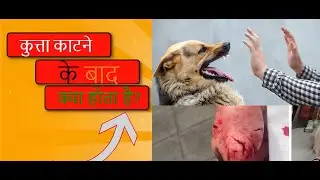 What happens after a dog bite? | कुत्ता काटने के बाद क्या होता है? | Hindi Video